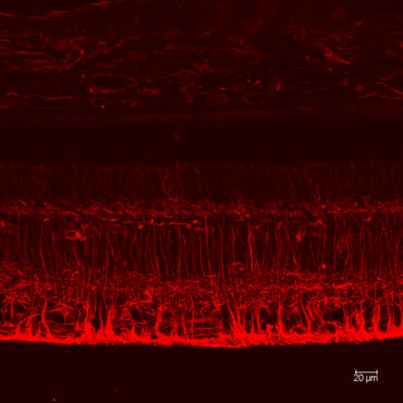 Müller cells from human retina inmunostained with anti-vimentin